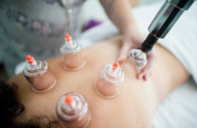 What does Cupping do in a Massage?